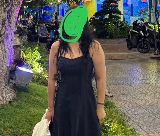 before photo: 팔지방흡입