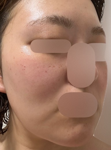 after photo: ルメッカ
