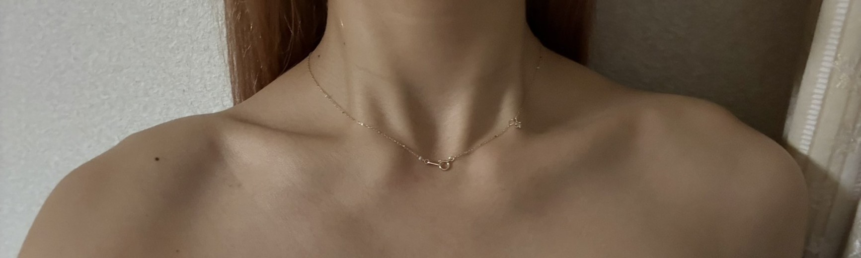 after photo: 肩ボトックス(僧帽筋)