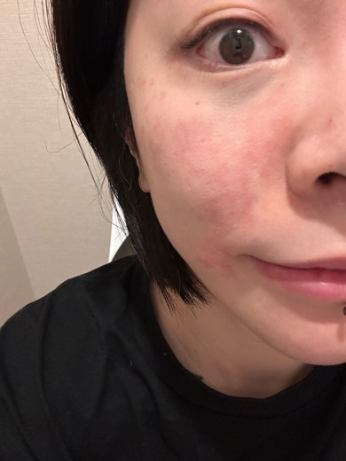 after photo: ジュベルック(Juvelook)