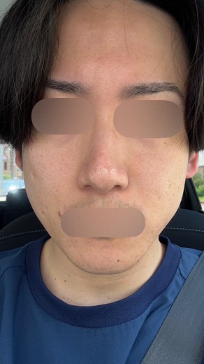 after photo: ポテンツァ(POTENZA)