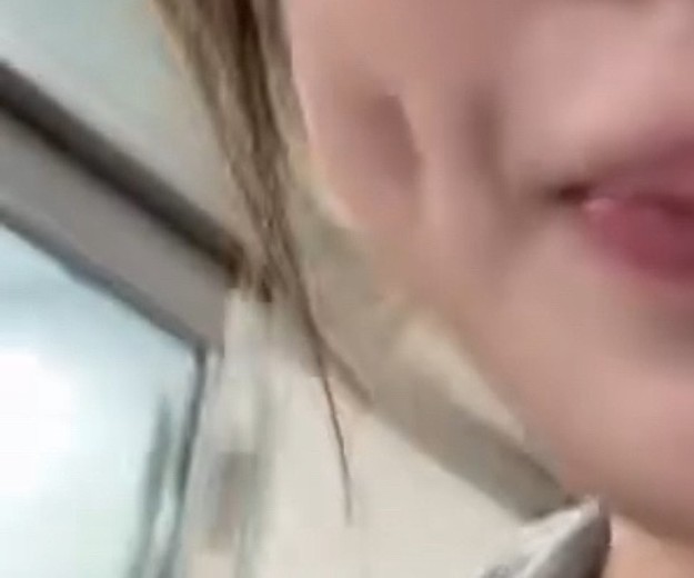 after photo: 보조개성형