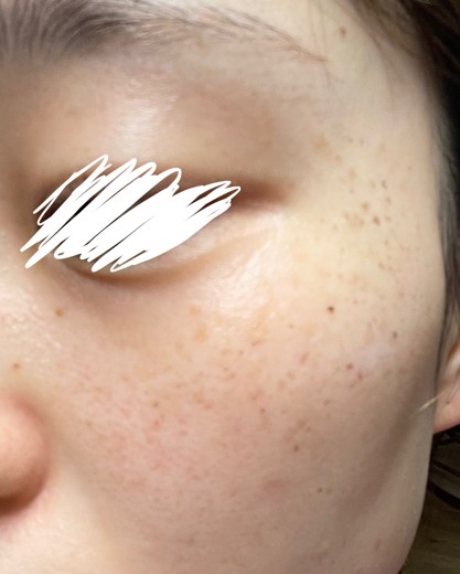 after photo: ルメッカ