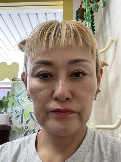 before photo: マッサージピール(コラーゲンピール)
