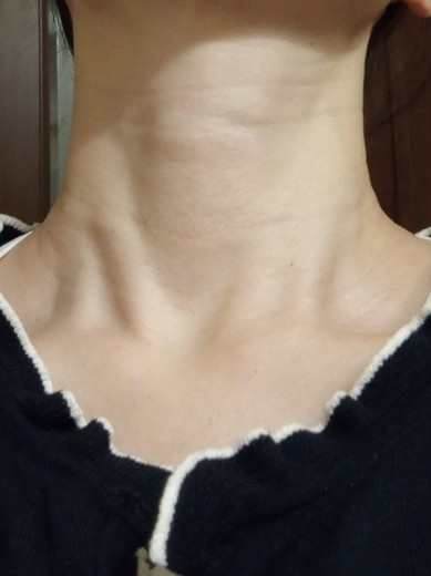 after photo: エレクトロポレーション