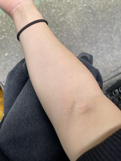 after photo: ダイエット点滴/注射