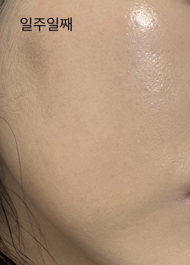 after photo: 쥬베룩