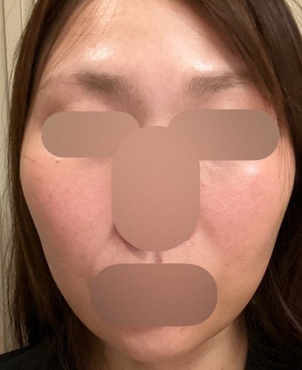 after photo: ソノクイーン(ハイフ)