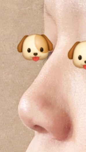 before photo: 콧대(보형물), 코끝(보형물)