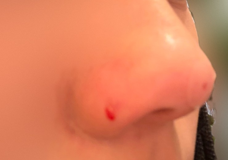 after photo: 코프팅