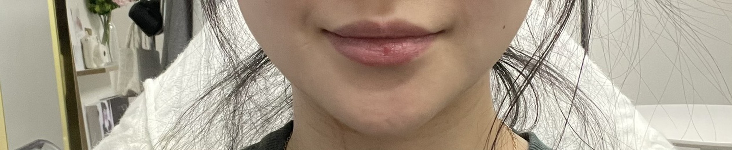 after photo: 인모드리프팅