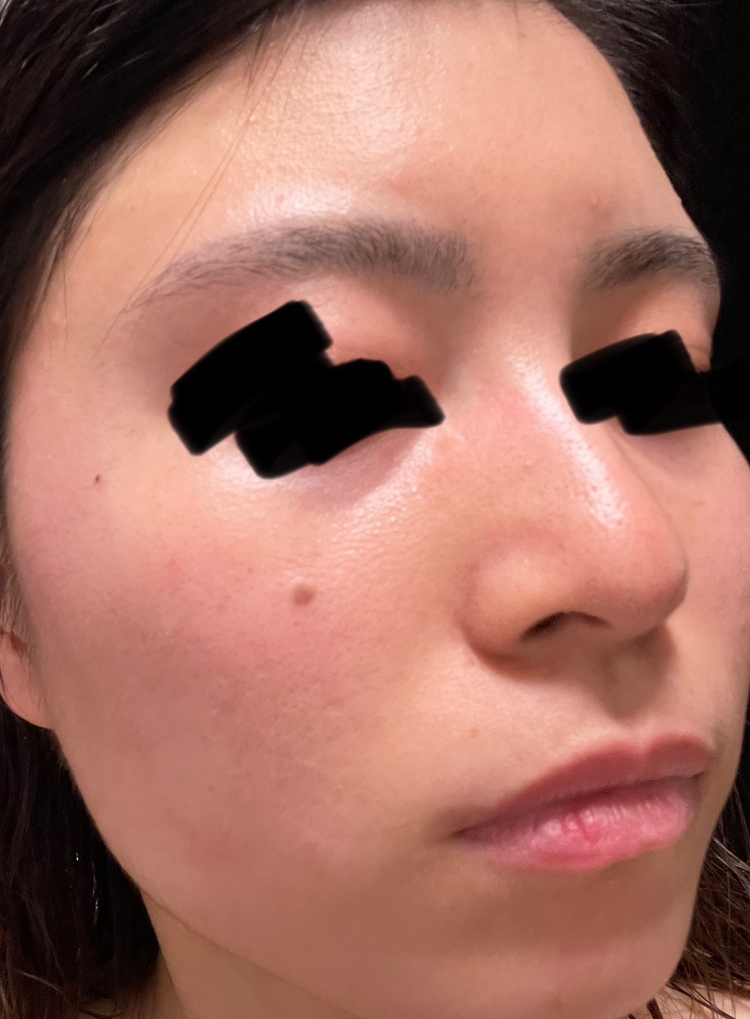 温冷エレクトロポレーション（3種の薬剤から選択） お悩みに