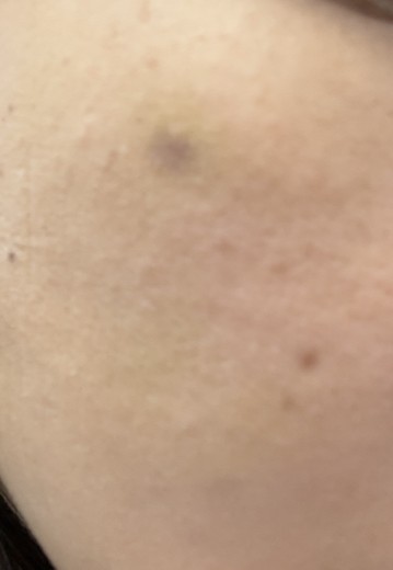 after photo: 쥬베룩