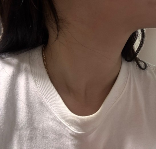 after photo: インモード