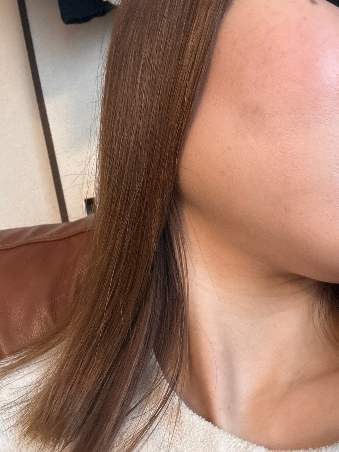 全顔シミ取り放題＋美顔レーザートーニング【1月15日迄にご予約頂いた