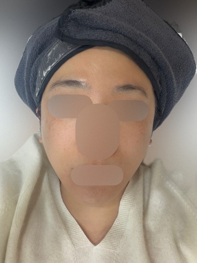 before photo: 튠라이너