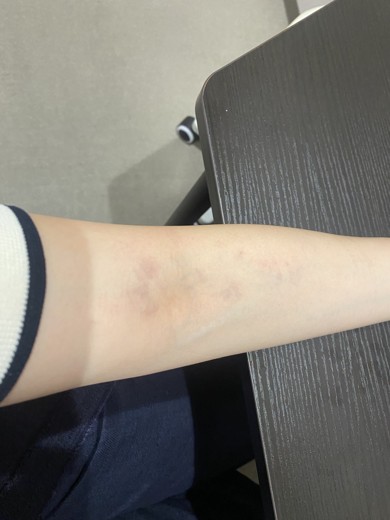 before photo: 白玉注射・点滴