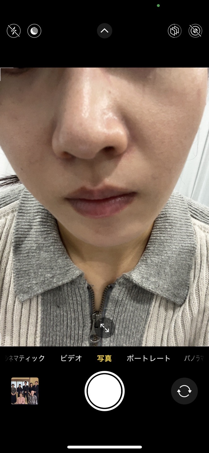 再来OK】ハイドラフェイシャル＋エレクトロポレーション | おおかみ