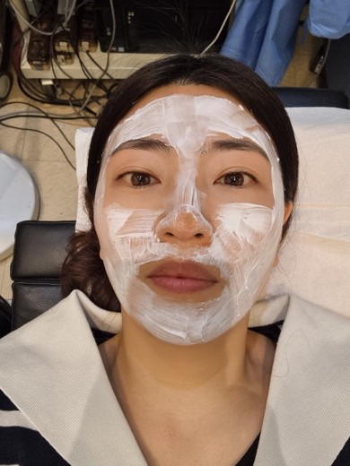 before photo: 프락셀레이저, 디오레듀얼