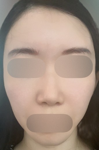after photo: ルメッカ