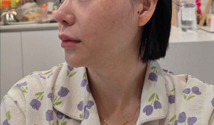 before photo: 네오빔