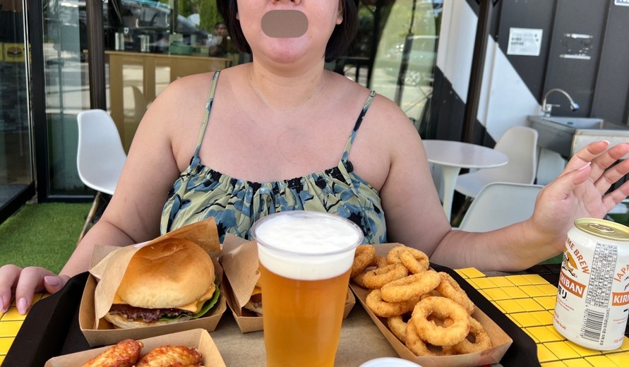 before photo: 이중턱지방흡입, 얼굴지방흡입, 볼지방흡입