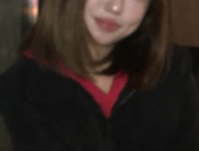 after photo: 보조개성형