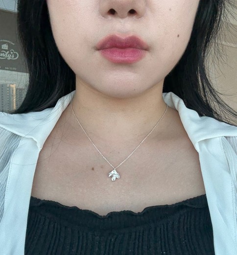 after photo: 사각턱보톡스