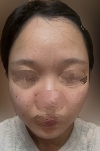 after photo: 診断・検査