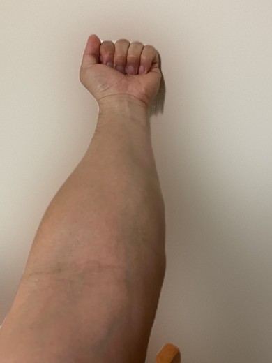 after photo: 白玉注射・点滴