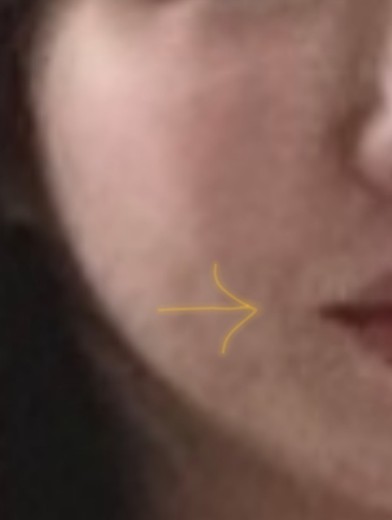 before photo: 리니어지