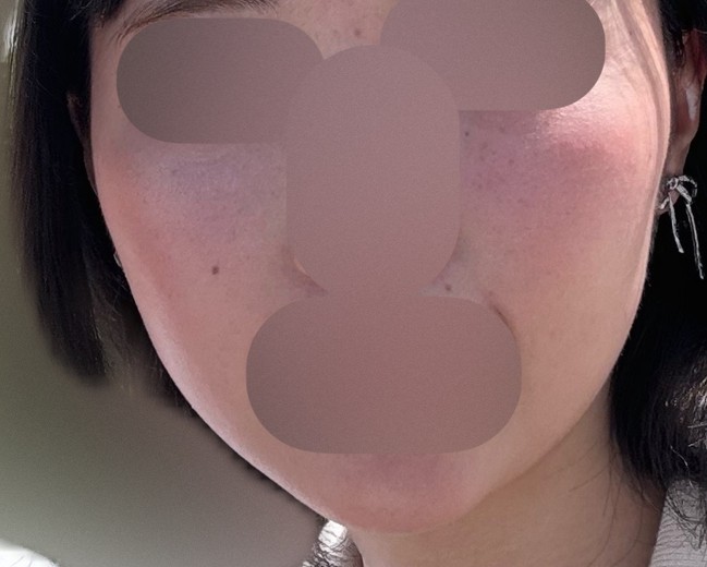 before photo: 診断・検査