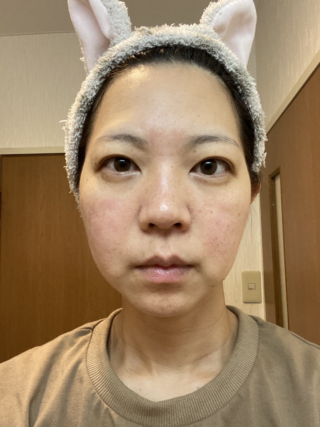 何度でも可】全顔シミ取り放題＋美顔レーザートーニング | ZX-CLINIC