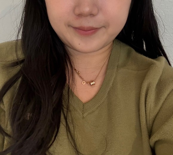 before photo: 보조개성형