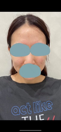 before photo: ポテンツァ(POTENZA)