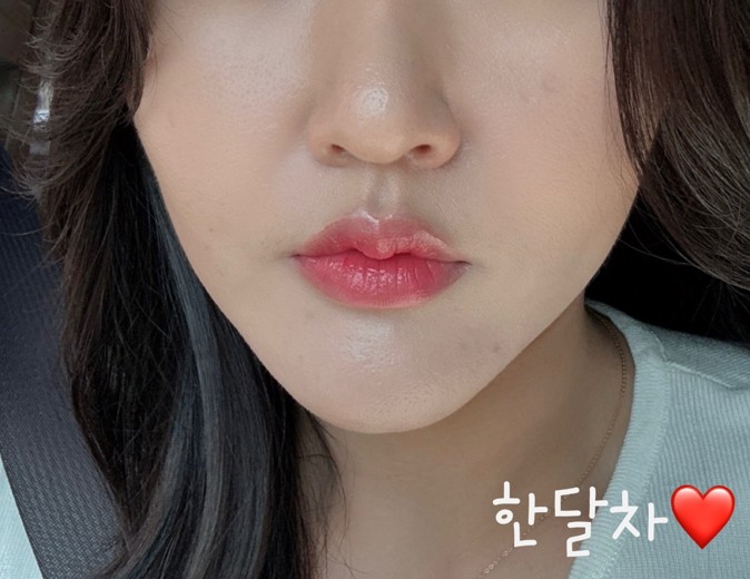 after photo: 쥬베룩