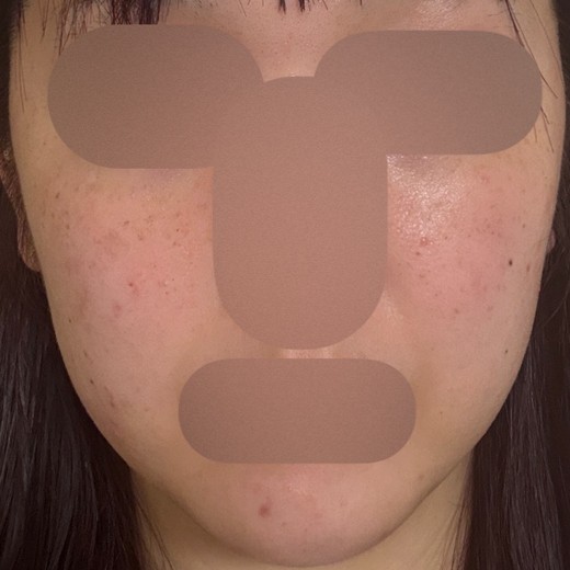after photo: ルメッカ
