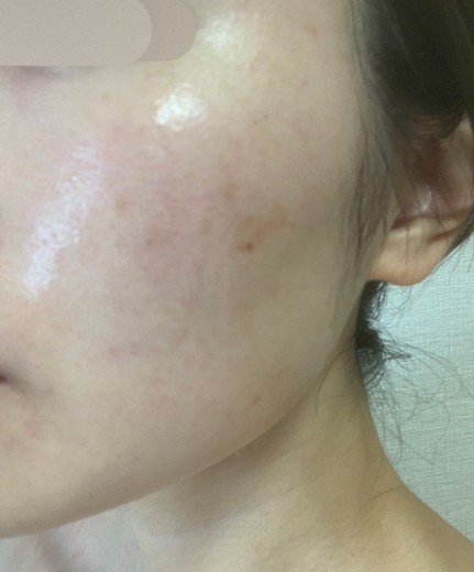 after photo: ルメッカ