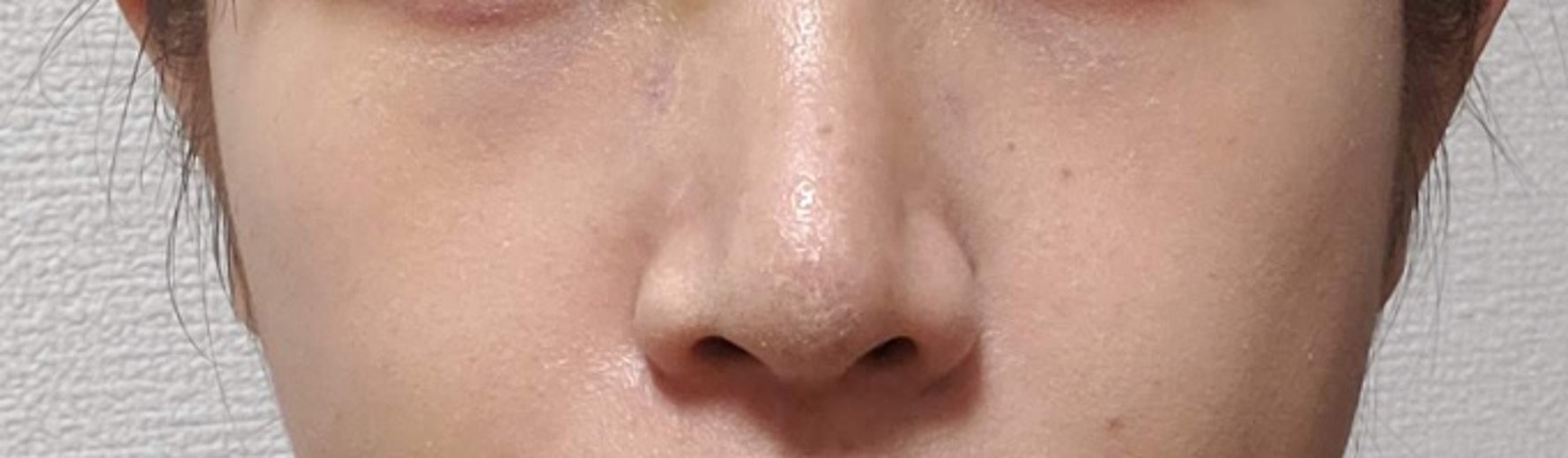 ヴェリテクリニック大阪院の施術口コミ113件, image size:1779x520