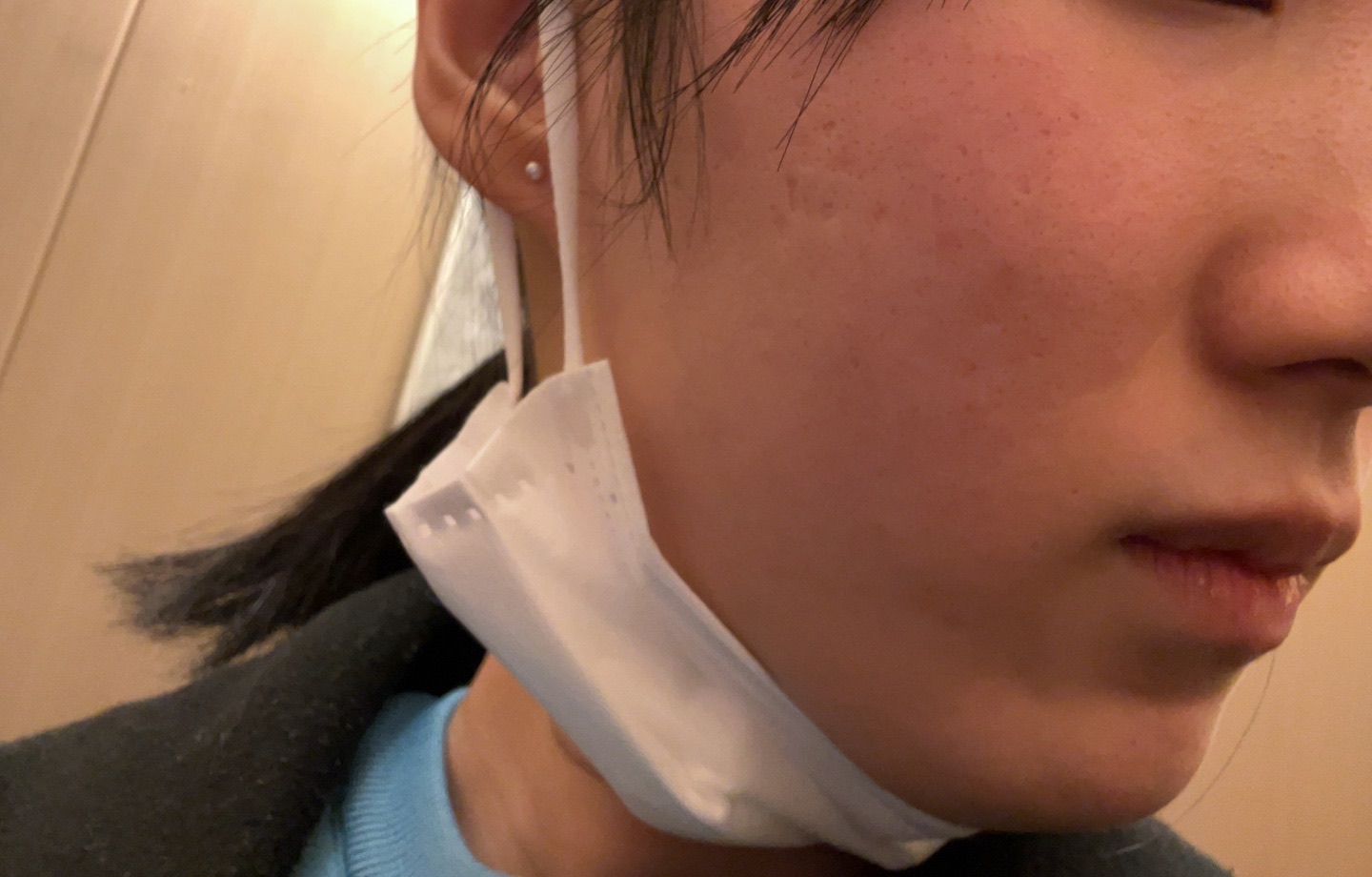 女性限定】顔＋VIOセット脱毛｜ジェントルマックスプロ／ジェントル