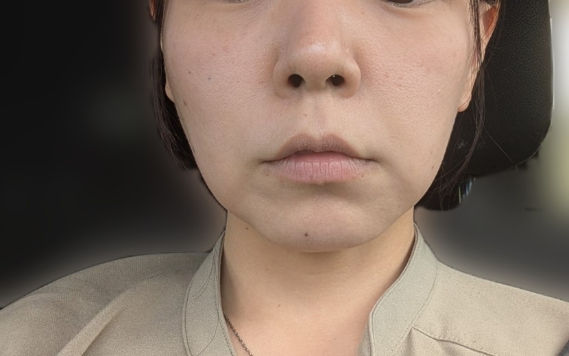 after photo: ソノクイーン(ハイフ)