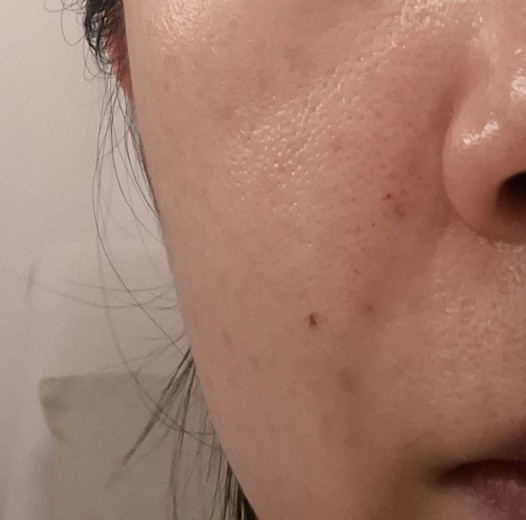 after photo: 쥬브젠