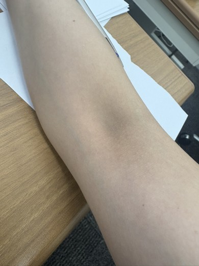 before photo: ビタミン注射・点滴