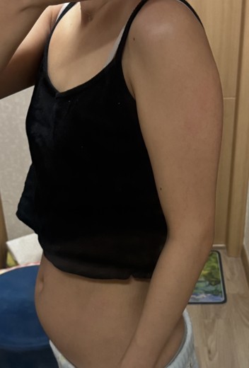 before photo: 복부지방흡입