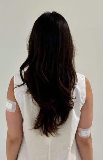 after photo: 팔지방분해주사