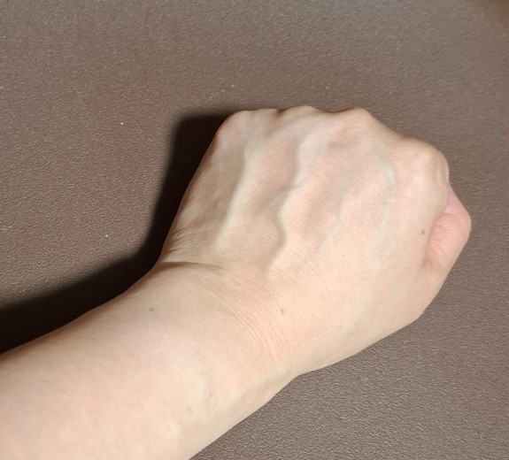 before photo: 白玉注射・点滴