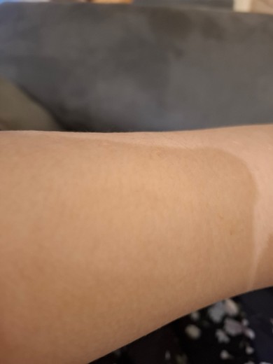 after photo: 인모드바디