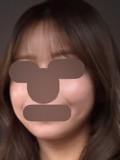 before photo: ボルニューマ