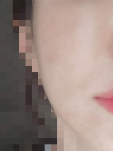 after photo: 리니어지