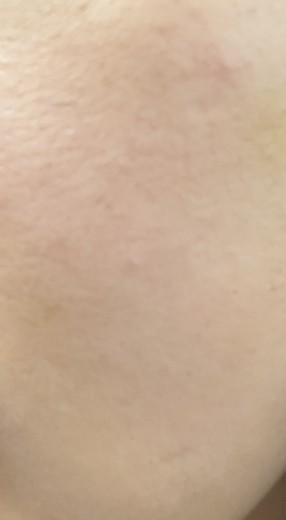 before photo: 쥬베룩